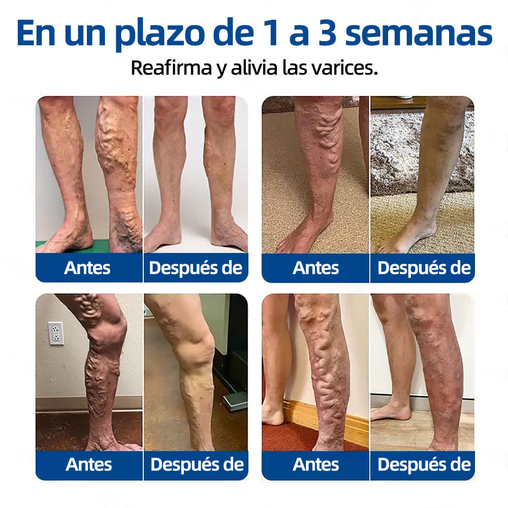 ✅𝐅𝐥𝐨𝐫𝐢𝐬𝐦𝐚®🍁💖𝐎𝐛𝐣𝐞𝐭𝐢𝐯𝐨 𝐕𝐞𝐧𝐨𝐬𝐨 𝐏𝐚𝐫𝐜𝐡𝐞 𝐃𝐞 𝐌𝐢𝐜𝐫𝐨𝐚𝐠𝐮𝐣𝐚𝐬⚡Alivio instantáneo, resultados a largo plazo