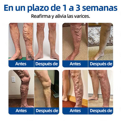 ✅𝐅𝐥𝐨𝐫𝐢𝐬𝐦𝐚®🍁💖𝐎𝐛𝐣𝐞𝐭𝐢𝐯𝐨 𝐕𝐞𝐧𝐨𝐬𝐨 𝐏𝐚𝐫𝐜𝐡𝐞 𝐃𝐞 𝐌𝐢𝐜𝐫𝐨𝐚𝐠𝐮𝐣𝐚𝐬⚡Alivio instantáneo, resultados a largo plazo